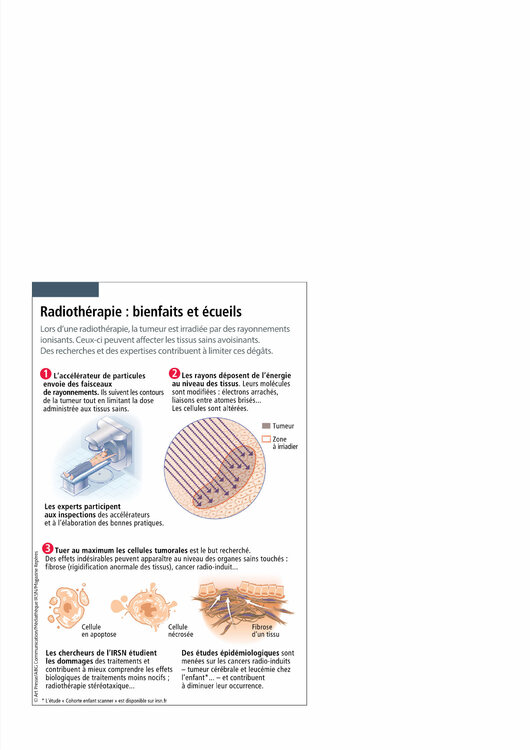 radiothérapie.png